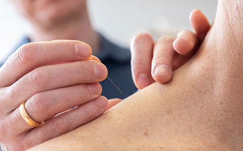Praxis-castorphmuellersika – Dr. Müller besitzt die Zusatzbezeichnung Akupunktur